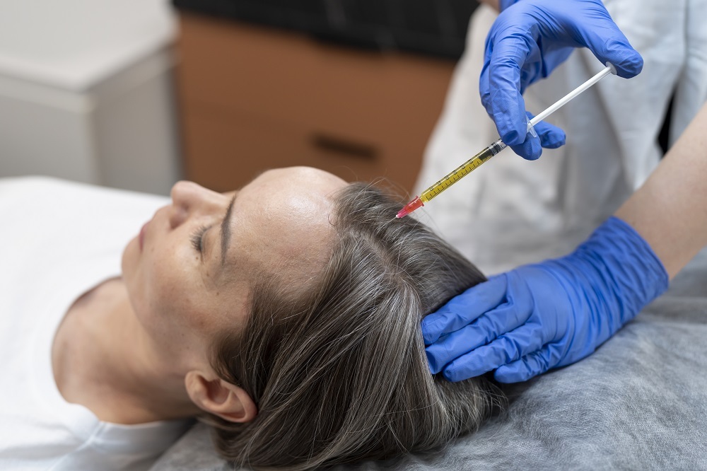 Platelet rich plasma therapy for hair loss